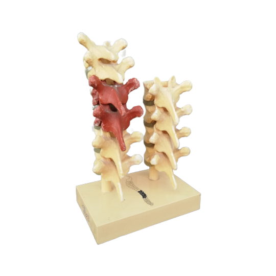Anatomisch Model Rugwervels 1
