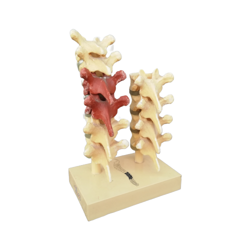 Anatomisch Model Rugwervels