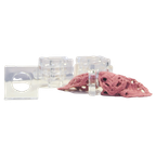 Set Plexiglas Servetringen X10 thumbnail 1
