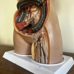 Torso🫀 thumbnail 8