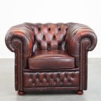 Comfortabele En Karaktervolle Donkerrode Engelse Rundleren Chesterfield Fauteuil Met Bolpootjes thumbnail 3