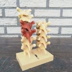 Anatomisch Model Rugwervels thumbnail 3