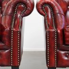 Unieke Set Van 4 Mooie Engelse Rundleren Chesterfield Clubfauteuils In Een Gevlamde Rode Kleur thumbnail 14