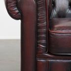Grote Donkerrode Gevlamde Rundleren Chesterfield Clubfauteuil/ Armchair thumbnail 3