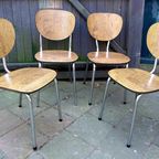 Prachtige Set Van 4 Vintage Retro Formica Stoelen thumbnail 2