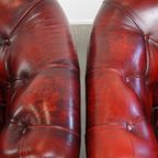 Unieke Set Van 4 Mooie Engelse Rundleren Chesterfield Clubfauteuils In Een Gevlamde Rode Kleur thumbnail 9