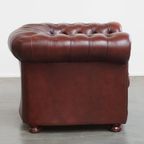 Engelse Rundleren Chesterfield Fauteuil Van Springvale Met Een Luxe Uitstraling thumbnail 3