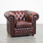 Comfortabele En Karaktervolle Donkerrode Engelse Rundleren Chesterfield Fauteuil Met Bolpootjes thumbnail 2