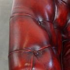 Unieke Set Van 4 Mooie Engelse Rundleren Chesterfield Clubfauteuils In Een Gevlamde Rode Kleur thumbnail 6