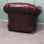 Exclusieve Chesterfield Clubfauteuil Uit 1970 thumbnail 4