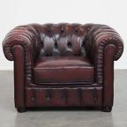 Grote Donkerrode Gevlamde Rundleren Chesterfield Clubfauteuil/ Armchair thumbnail 5