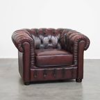 Grote Donkerrode Gevlamde Rundleren Chesterfield Clubfauteuil/ Armchair thumbnail 11