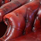Unieke Set Van 4 Mooie Engelse Rundleren Chesterfield Clubfauteuils In Een Gevlamde Rode Kleur thumbnail 3