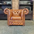 Chesterfield First Class Fauteuil - Cloudy Brown Old thumbnail 2