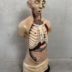 Antiek Anatomisch Model – Somso thumbnail 8