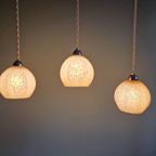 Art Deco Hanglamp In Roze Gespikkeld Glas (3 Beschikbaar) thumbnail 12