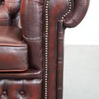 Comfortabele En Karaktervolle Donkerrode Engelse Rundleren Chesterfield Fauteuil Met Bolpootjes thumbnail 10