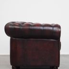 Grote Donkerrode Gevlamde Rundleren Chesterfield Clubfauteuil/ Armchair thumbnail 4