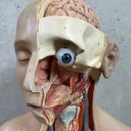 Antiek Anatomisch Model – Somso thumbnail 6