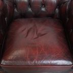 Grote Donkerrode Gevlamde Rundleren Chesterfield Clubfauteuil/ Armchair thumbnail 8