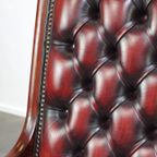 Donker Rode Gevlamde Engelse Chesterfield Fauteuil Van Rundleer En Hout, Victoriaans Model thumbnail 11