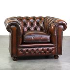 Prachtige Engelse Cognac Bruine Rundleren Chesterfield Fauteuil thumbnail 2